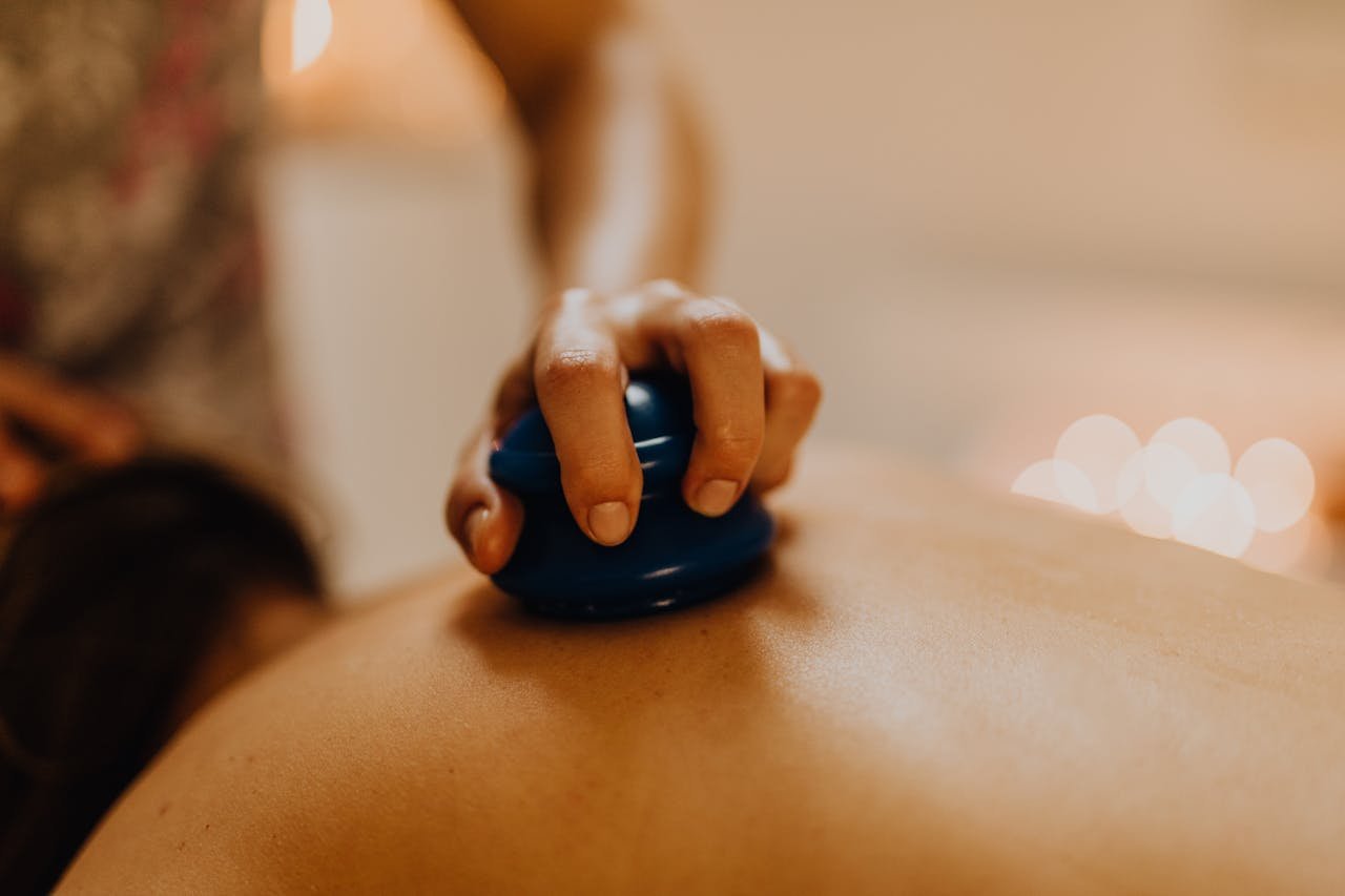 Close-up of cupping therapy on a persons back, focusing on relaxation and wellness.